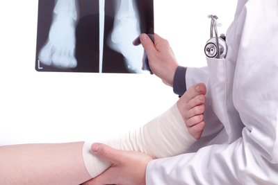 Doctor showing xray after the surgery in patient.